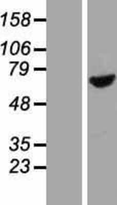 Western Blot: BBS1 Overexpression Lysate [NBP2-06306]