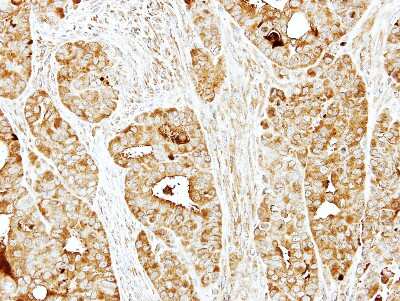 Immunohistochemistry-Paraffin: BBS10 Antibody [NBP1-32740]