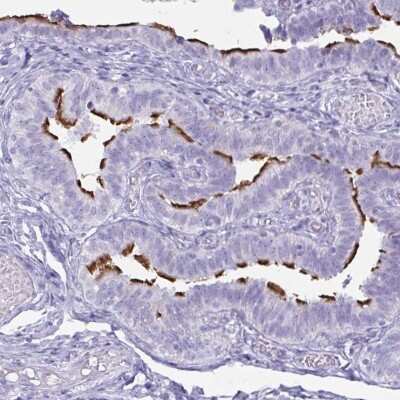 Immunohistochemistry-Paraffin: BBS10 Antibody [NBP2-32399]