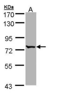 Western Blot: BBS10 Antibody [NBP1-32740]