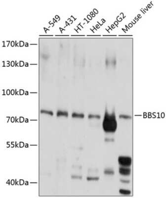 Western Blot: BBS10 AntibodyBSA Free [NBP2-92569]