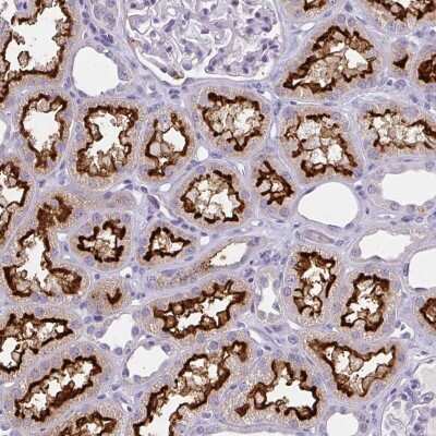 Immunohistochemistry: BBS12 Antibody [NBP2-38939]