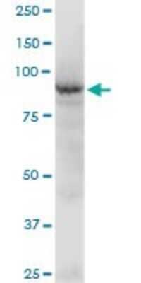 Western Blot: BBS12 Antibody [H00166379-B01P]