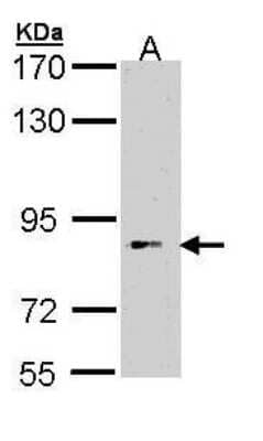 Western Blot: BBS12 Antibody [NBP1-32973]