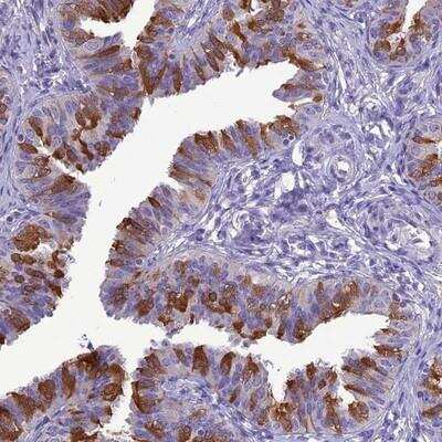 Immunohistochemistry: BBS2 Antibody [NBP1-91695]