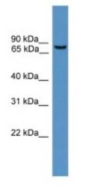 Western Blot: BBS2 Antibody [NBP1-69082]