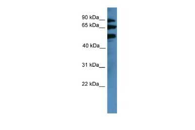 Western Blot: BBS2 Antibody [NBP2-87065]