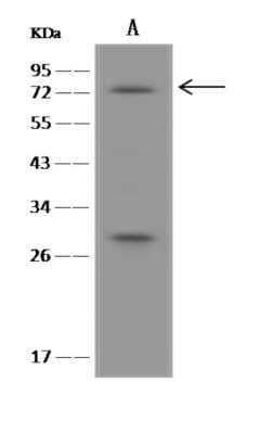 Western Blot: BBS2 Antibody [NBP3-06335]