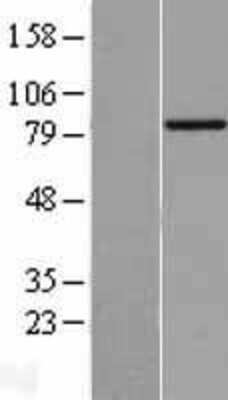 Western Blot: BBS2 Overexpression Lysate [NBL1-07928]