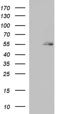 Western Blot: BBS4 Antibody (OTI2D5) [NBP2-46564]