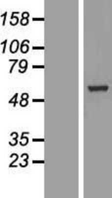 Western Blot: BBS4 Overexpression Lysate [NBL1-07929]