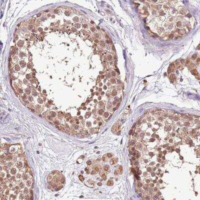 Immunohistochemistry-Paraffin: BBS5 Antibody [NBP2-46722]