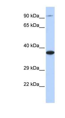 Western Blot: BBS5 Antibody [NBP1-55191]