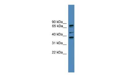 Western Blot: BBS5 Antibody [NBP2-87066]