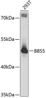 Western Blot: BBS5 AntibodyAzide and BSA Free [NBP3-04691]