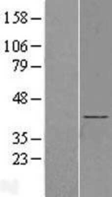 Western Blot: BBS5 Overexpression Lysate [NBL1-07930]