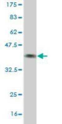 Western Blot: BBS7 Antibody (2H6) [H00055212-M01]