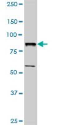 Western Blot: BBS7 Antibody [H00055212-D01P]