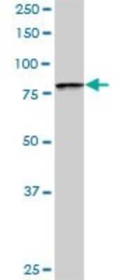 Western Blot: BBS7 Antibody [H00055212-D01P]