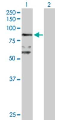 Western Blot: BBS7 Antibody [H00055212-D01P]