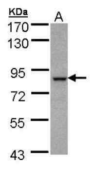 Western Blot: BBS7 Antibody [NBP1-32754]