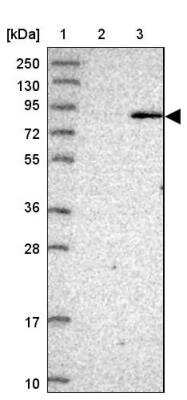 Western Blot: BBS7 Antibody [NBP1-88690]