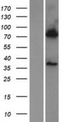 Western Blot: BBS7 Overexpression Lysate [NBP2-06854]