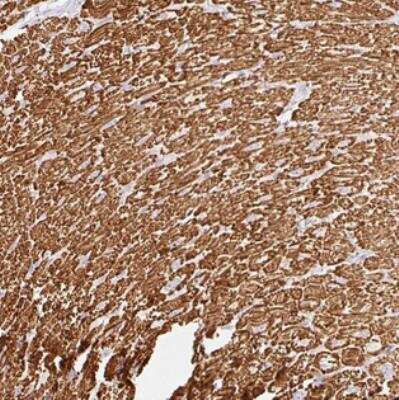 Immunohistochemistry: BBSome Interacting Protein 1 Antibody [NBP2-30510]