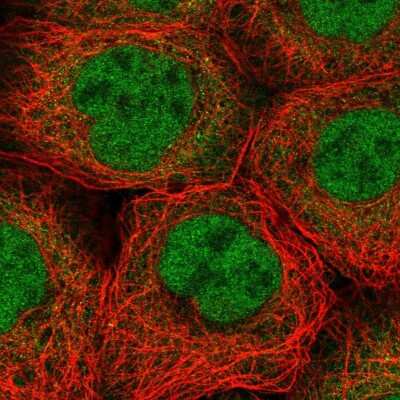 Immunocytochemistry/ Immunofluorescence: BBX Antibody [NBP2-38633]