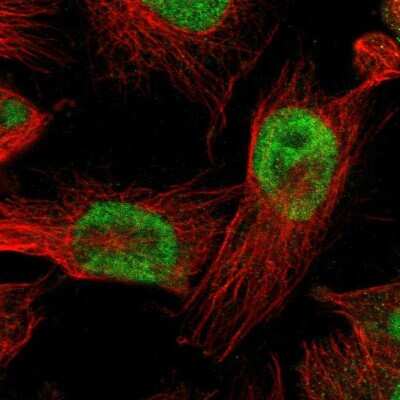 Immunocytochemistry/ Immunofluorescence: BBX Antibody [NBP2-47542]