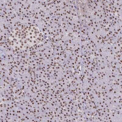 Immunohistochemistry-Paraffin: BBX Antibody [NBP2-38633]