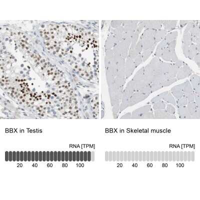 Immunohistochemistry-Paraffin: BBX Antibody [NBP2-47542]