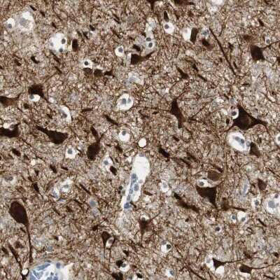 Immunohistochemistry-Paraffin: BBX Antibody [NBP2-47542]