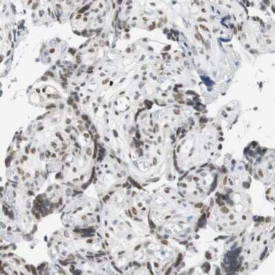 Immunohistochemistry-Paraffin: BBX Antibody [NBP2-47542]