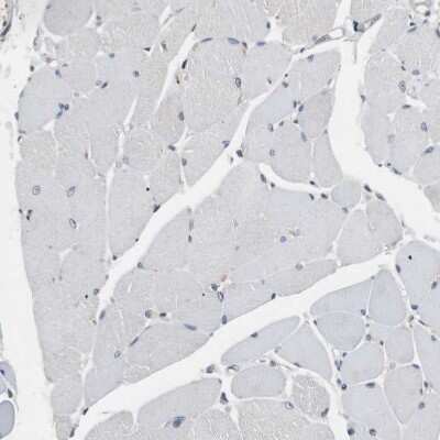 Immunohistochemistry-Paraffin: BBX Antibody [NBP2-47542]