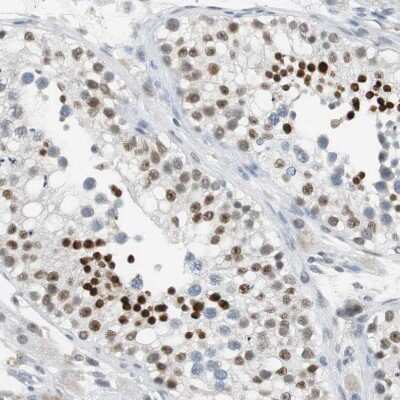 Immunohistochemistry-Paraffin: BBX Antibody [NBP2-47542]