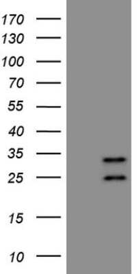 Western Blot: BCA3 Antibody (OTI1E3) [NBP2-46505]