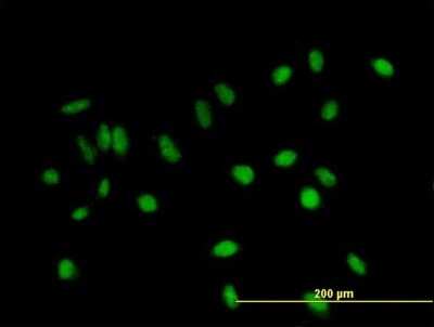 Immunocytochemistry/ Immunofluorescence: BCA3 Antibody [H00056672-B01P]