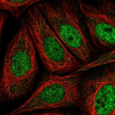 Immunocytochemistry/ Immunofluorescence: BCA3 Antibody [NBP2-57226]