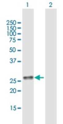 Western Blot: BCA3 Antibody [H00056672-B01P]