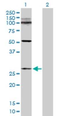 Western Blot: BCA3 Antibody [H00056672-D01P]