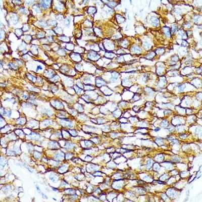 Immunohistochemistry-Paraffin: BCAM/CD239 Antibody (1G9W3) [NBP3-15879]