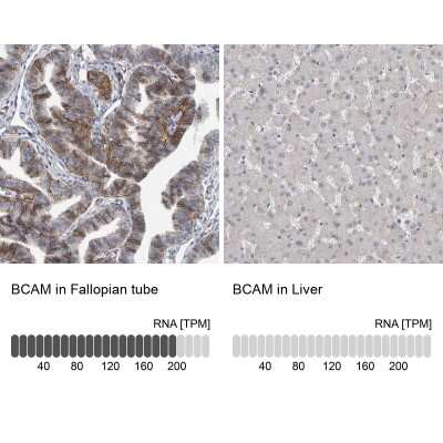 Immunohistochemistry-Paraffin: BCAM/CD239 Antibody [NBP2-31994]