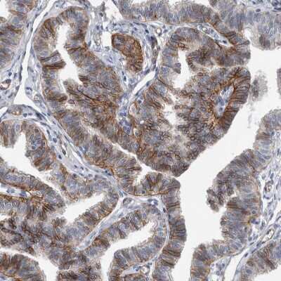 Immunohistochemistry-Paraffin: BCAM/CD239 Antibody [NBP2-31994]