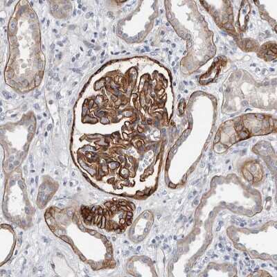 Immunohistochemistry-Paraffin: BCAM/CD239 Antibody [NBP2-31994]