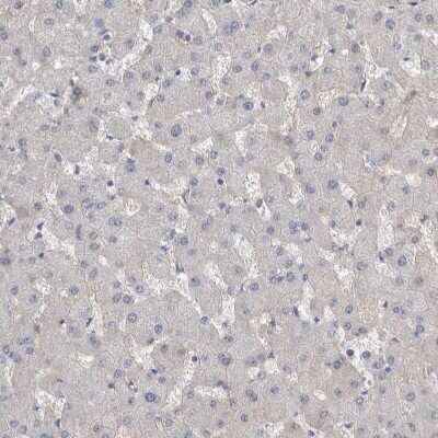 Immunohistochemistry-Paraffin: BCAM/CD239 Antibody [NBP2-31994]