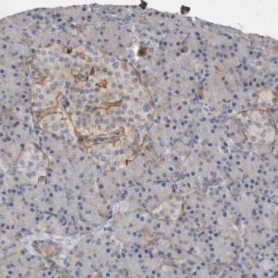 Immunohistochemistry-Paraffin: BCAM/CD239 Antibody [NBP2-31994]