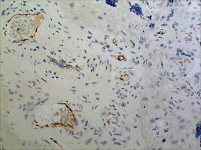 Immunohistochemistry-Paraffin: BCAM/CD239 Antibody (MM0107-1M39) - Azide and BSA Free [NBP2-12050]