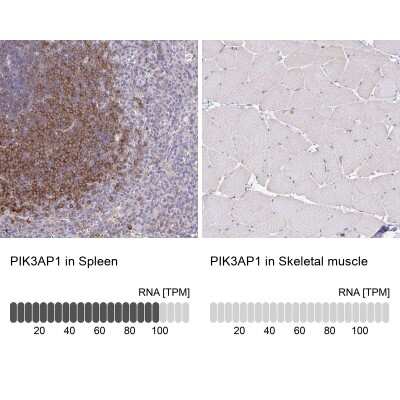 Immunohistochemistry-Paraffin: BCAP/PIK3AP1 Antibody [NBP2-38413]