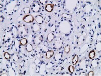 Immunohistochemistry: BCAP/PIK3AP1 Antibody (OTI7A11) - Azide and BSA Free [NBP2-72368]